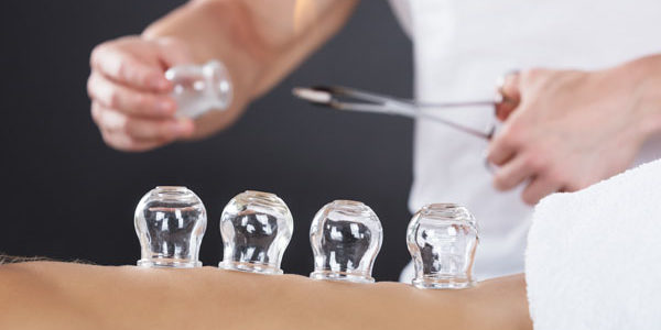 Cupping Traditional Chinese Medicine